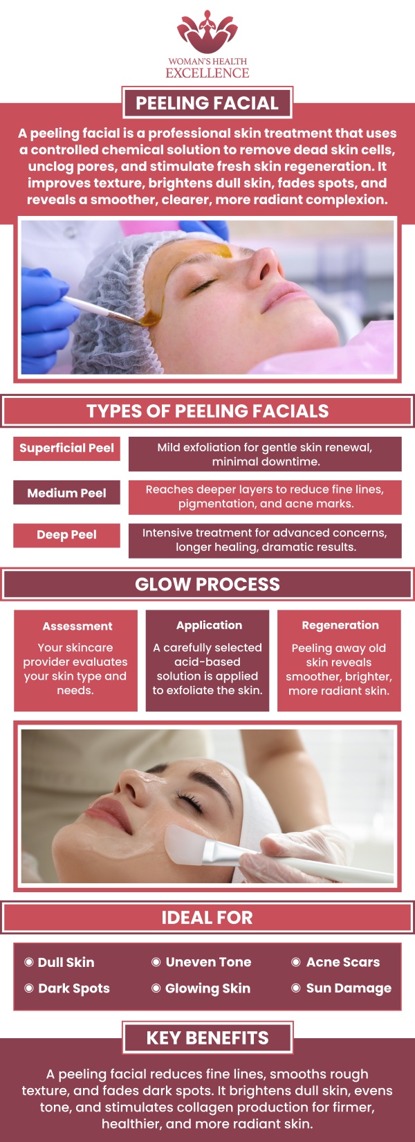 Bita Bahrami recommends peeling facials as an effective treatment to rejuvenate and enhance skin health. Tailored to individual skin types, these facials use chemical solutions to gently exfoliate and remove dead skin layers, promoting the growth of fresh, radiant skin. Ideal for addressing a range of skin issues from wrinkles to acne scars, Bita ensures a personalized approach for optimal results. For more information contact us today or book an appointment online. We have convenient locations to serve you in Arcadia, and Glendale, CA Bita Bahrami recommends peeling facials as an effective treatment to rejuvenate and enhance skin health. Tailored to individual skin types, these facials use chemical solutions to gently exfoliate and remove dead skin layers, promoting the growth of fresh, radiant skin. Ideal for addressing a range of skin issues from wrinkles to acne scars, Bita ensures a personalized approach for optimal results. For more information contact us today or book an appointment online. We have convenient locations to serve you in Arcadia, and Glendale, CA